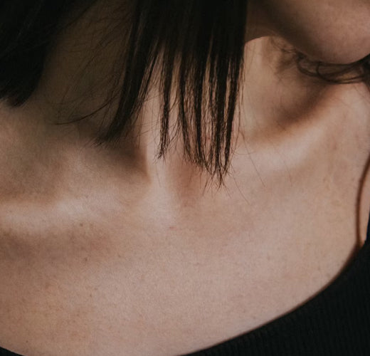 woman had forma skin tightening treatment - mobile